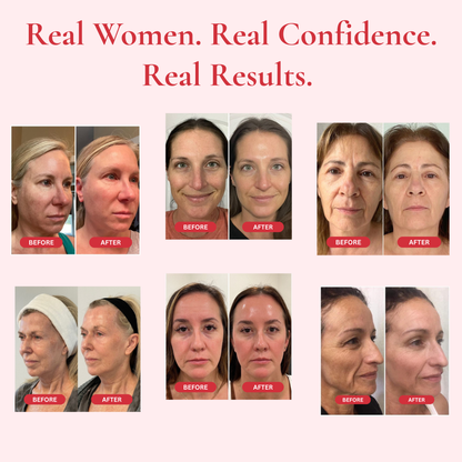 Evelare™ Madeca Cream Time Reverse