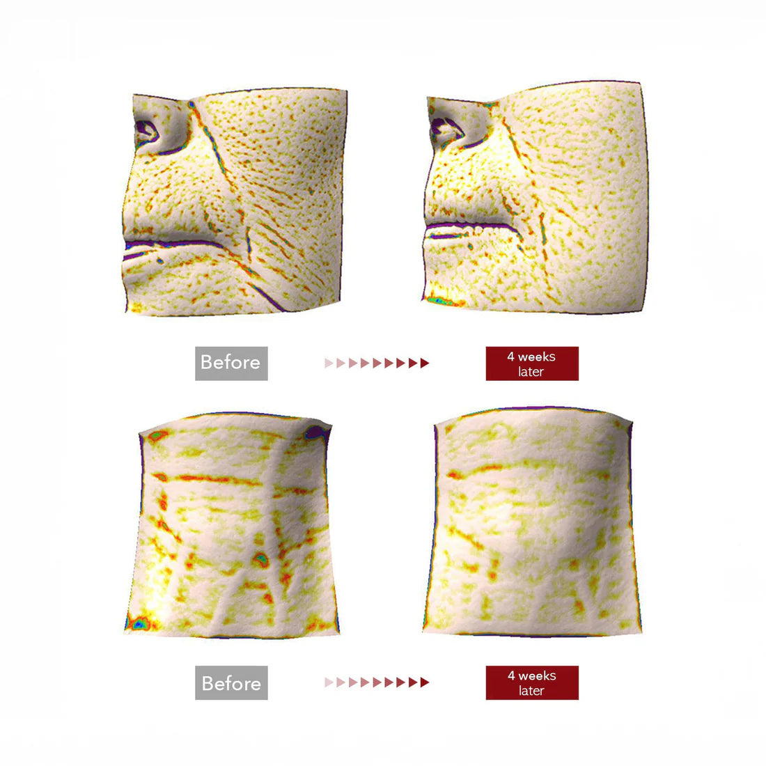 Evelare™ Madeca Cream Time Reverse