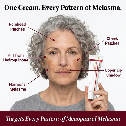 Melasma Time Reverse Cream